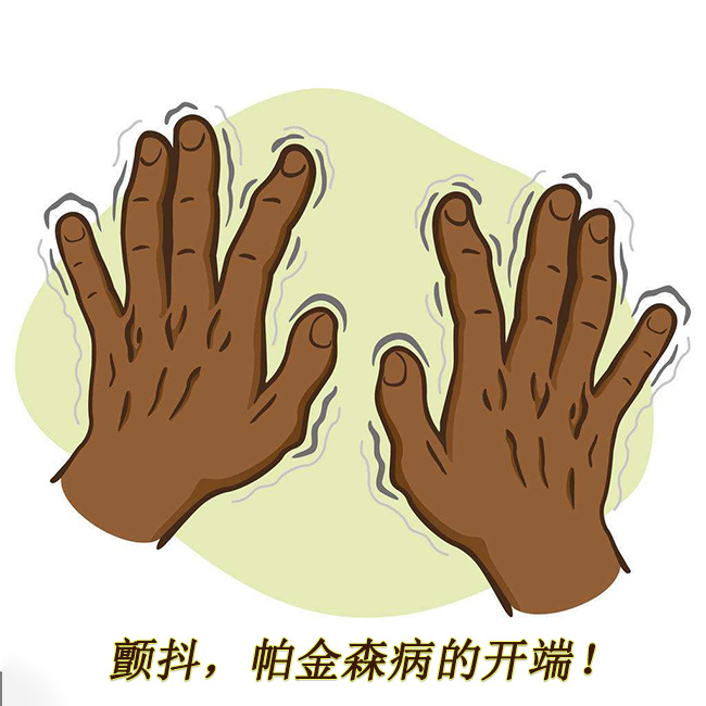 顫抖，帕金森病的開(kāi)端 帕金森的早期癥狀