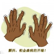 顫抖，帕金森病的開端 帕金森的癥狀有哪些